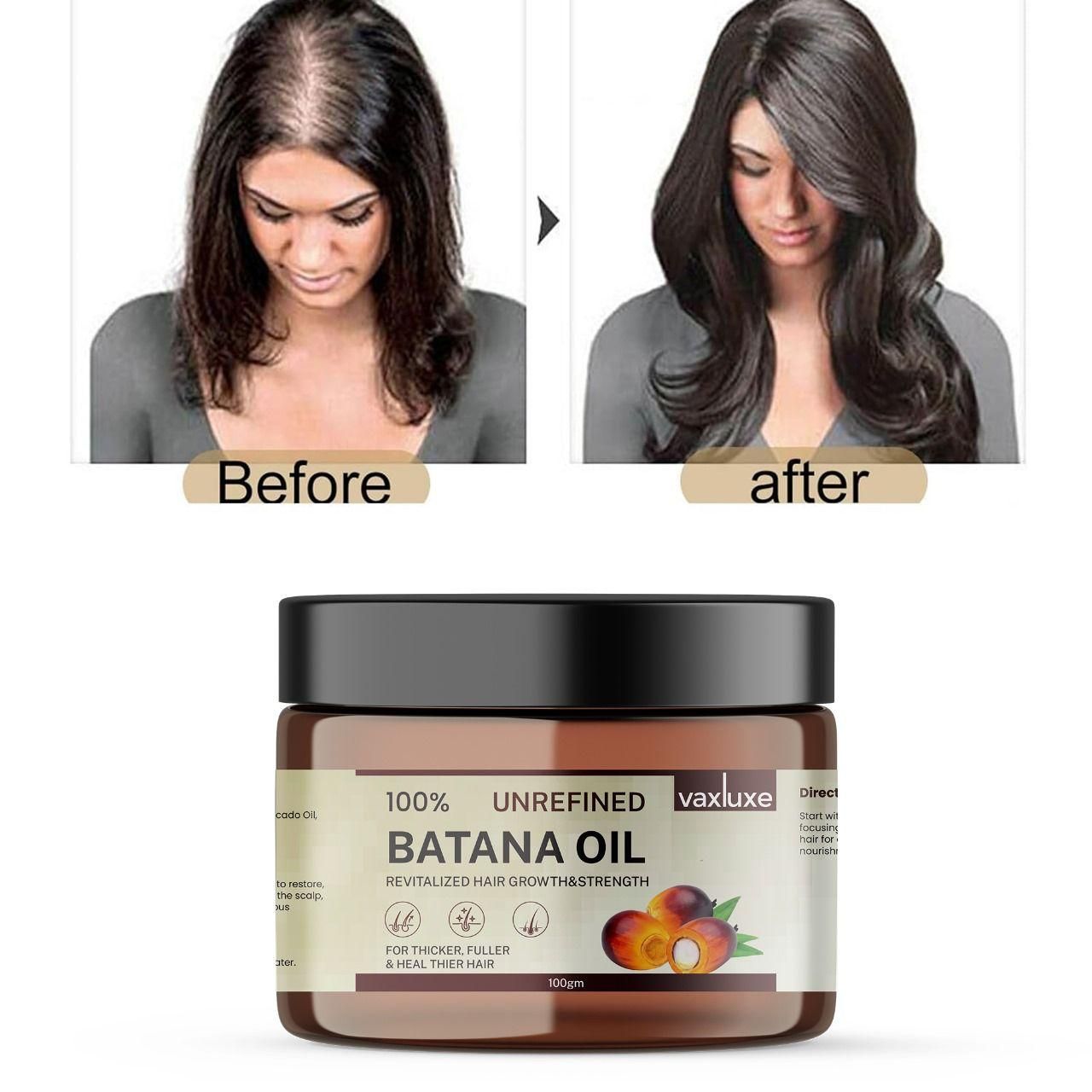Vaxluxe™ Batana Hair Growth Oil Revitalizing Strength & Repair – 100g